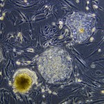 Стволовые клетки и их применение
